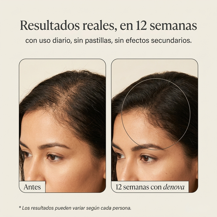 Roll-on Capilar · DENOVA